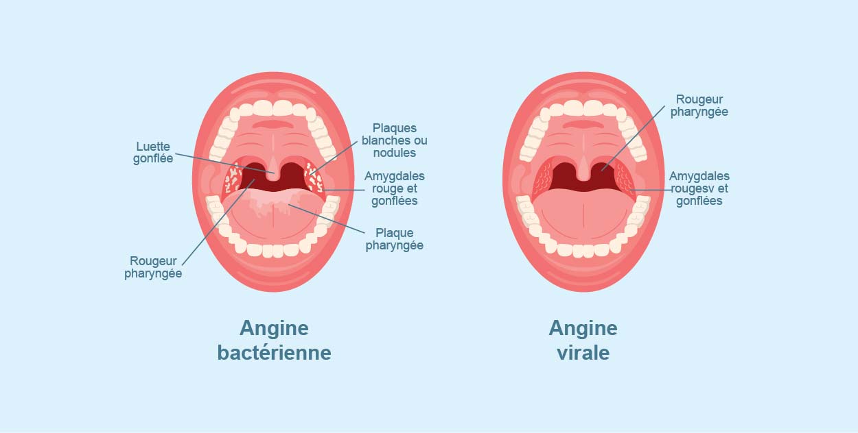 The Decoupling of Talent and Institution